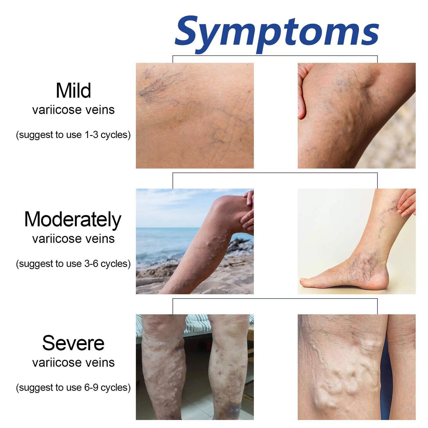 Body Neck Cream Care To Relieve Leg Discomfort