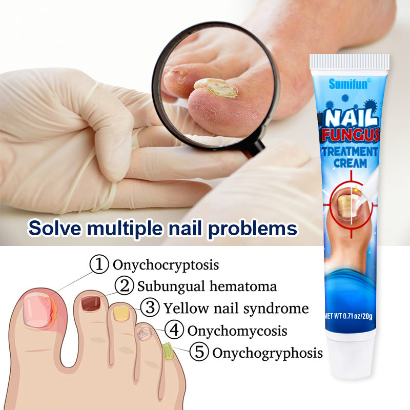 20g Onychomycosis Care Emulsifiable Paste