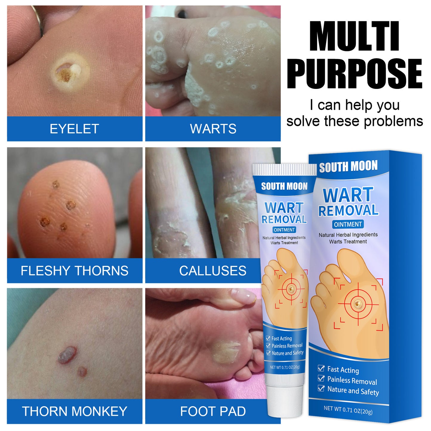 Remove Corns Cream To Smooth The Calluses