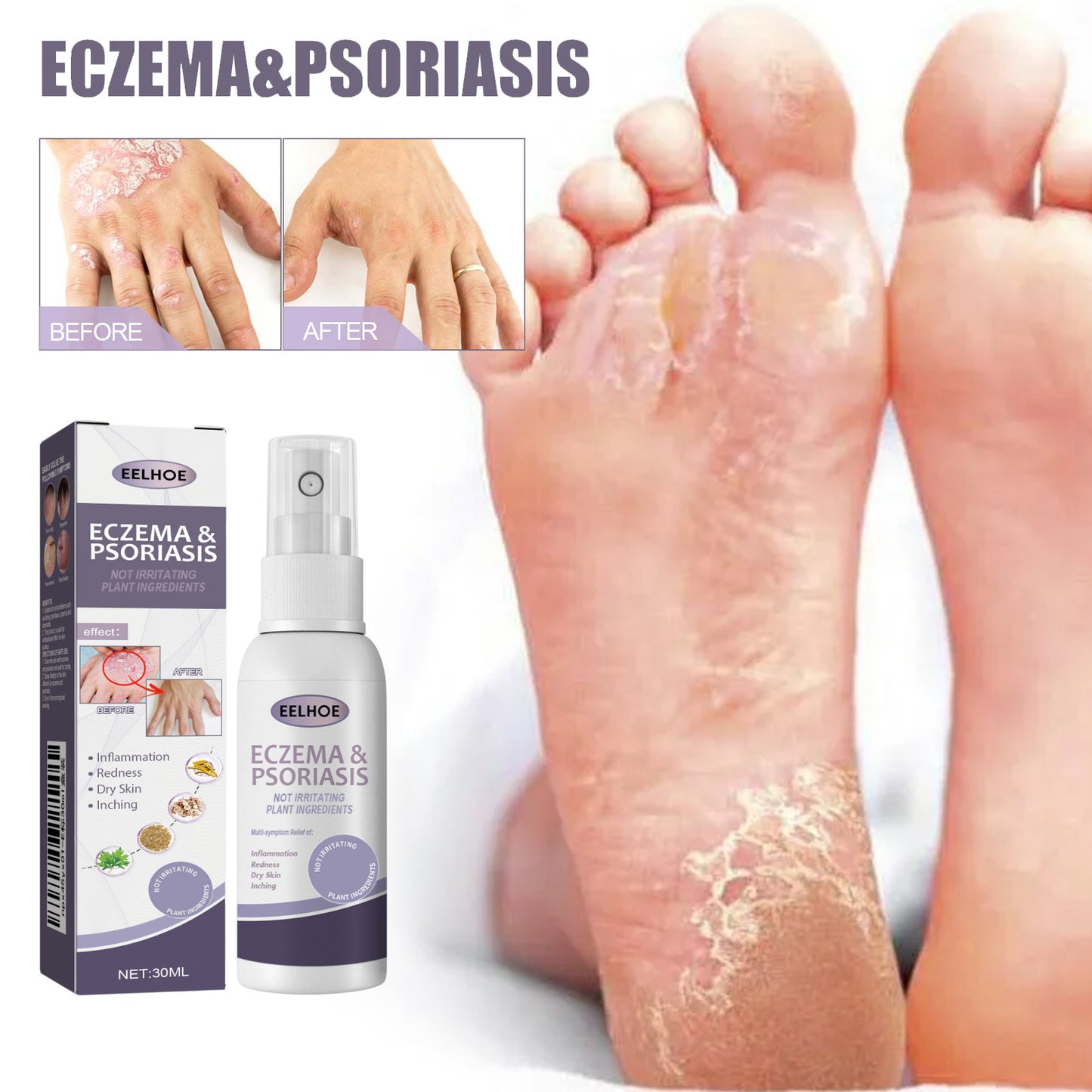 Hand And Foot Care Spray Relieves Dry Skin