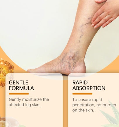 Leg Care Spray For Daily Relief Of Leg Varicosity your bynettafashion