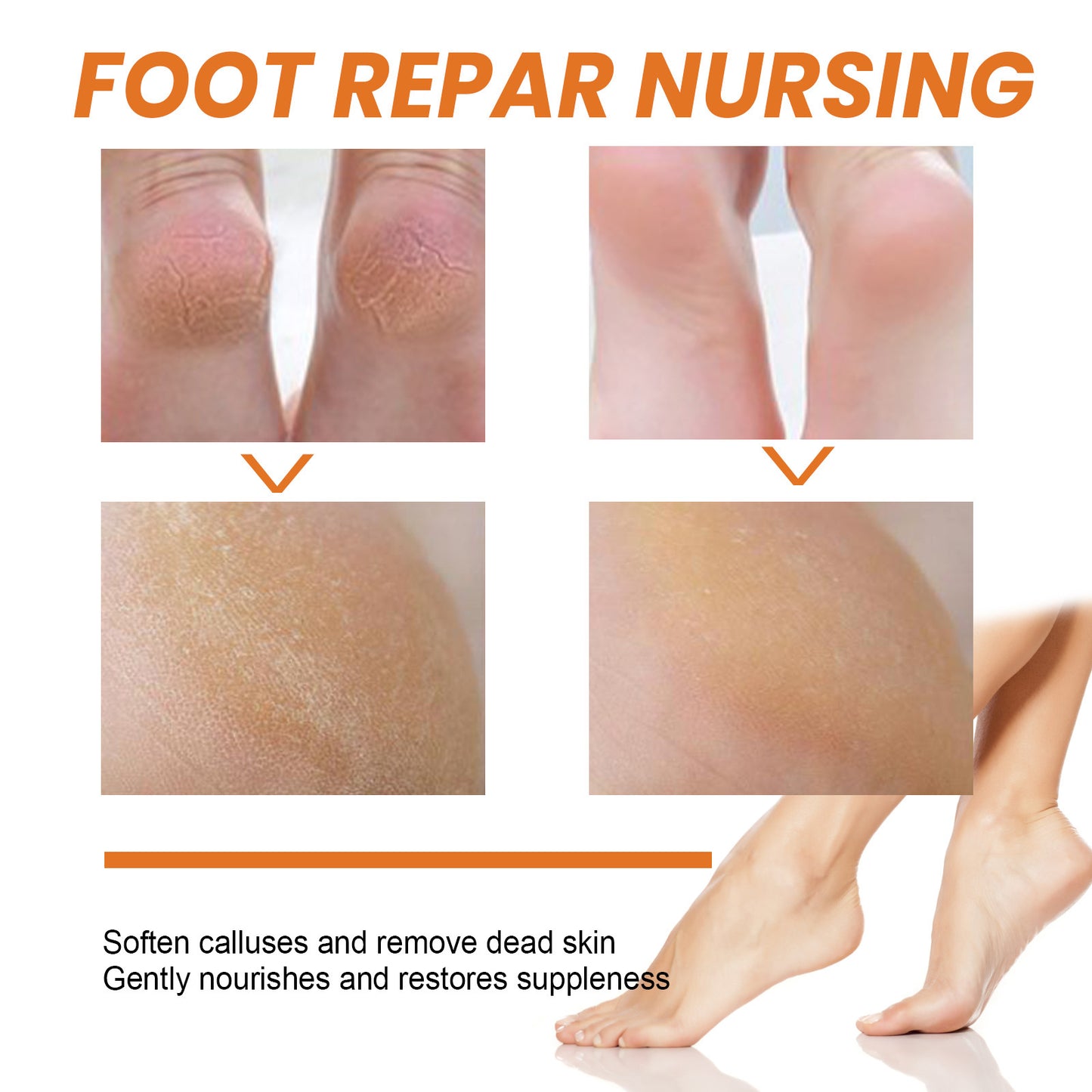Foot Exfoliating Spray Mild Callose Remove Dead Skin