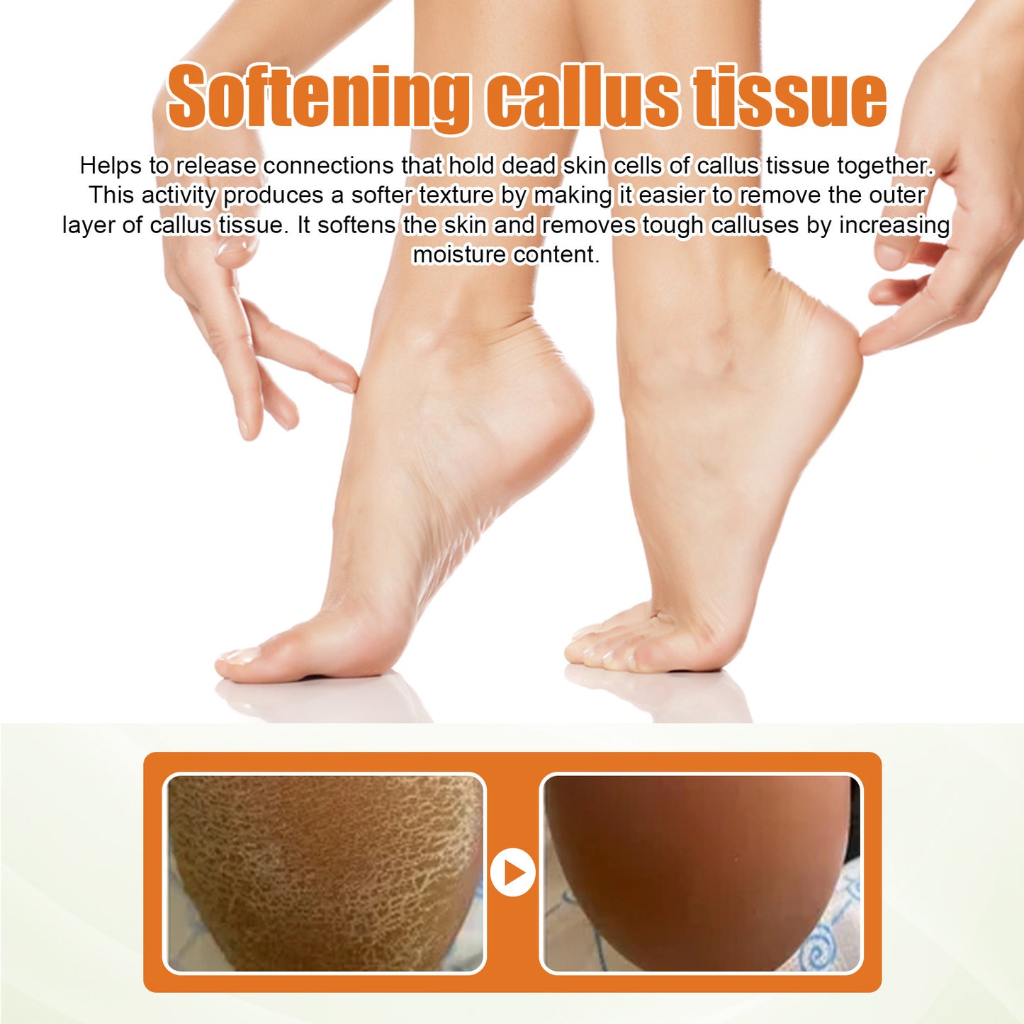 Foot Exfoliating Spray Mild Callose Remove Dead Skin